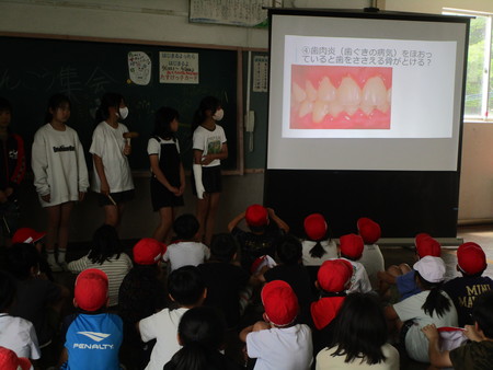 歯の健康集会